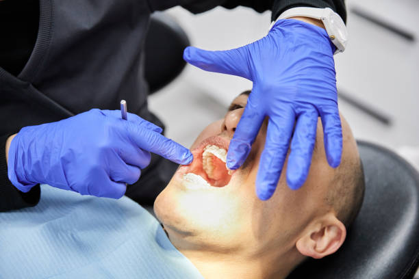 Best Emergency Dental Care for Broken or Chipped Teeth in Freeport, FL